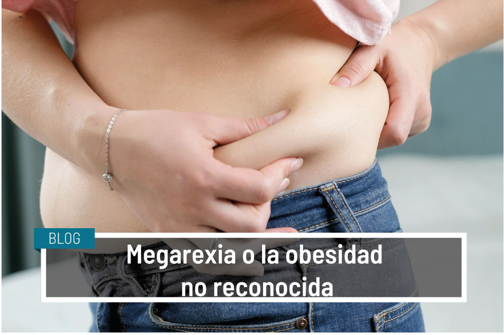 Megarexia: obesidad no reconocida. IVANE SALUD Blog